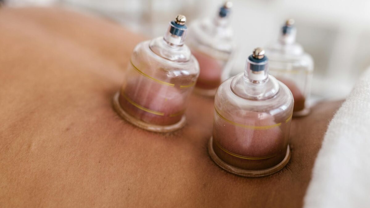 The Unexpected Benefits of Negative Pressure Cupping Therapy