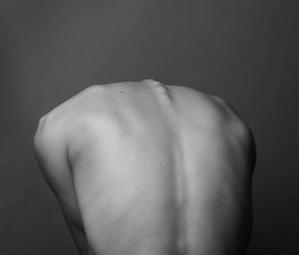 curved spine - superficial back myofascial line energy